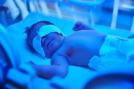 تشخیص بیماری زردی در نوزادان با تتوهای پوستی